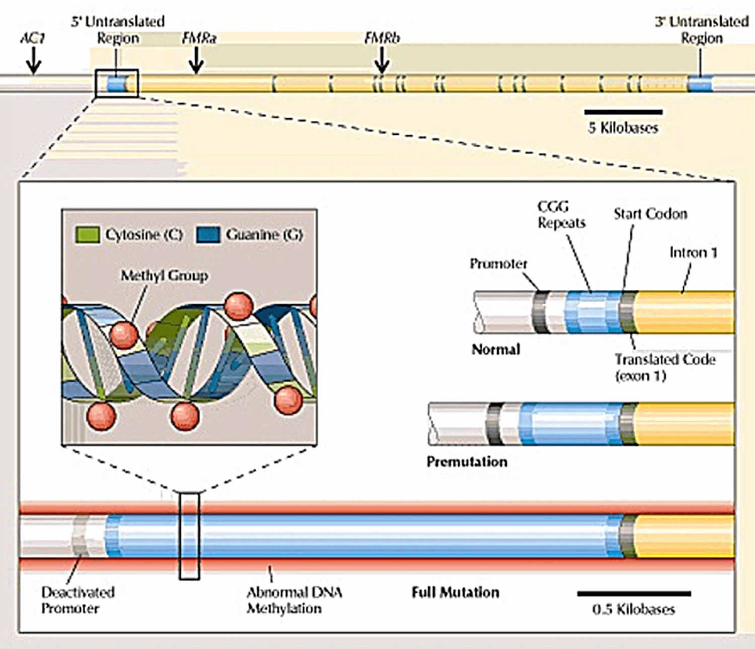 fragile-x-syndrome-causes-inheritance-symptoms-diagnosis-treatment