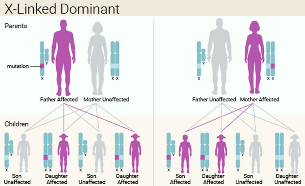 Fragile X syndrome causes, inheritance, symptoms, diagnosis & treatment