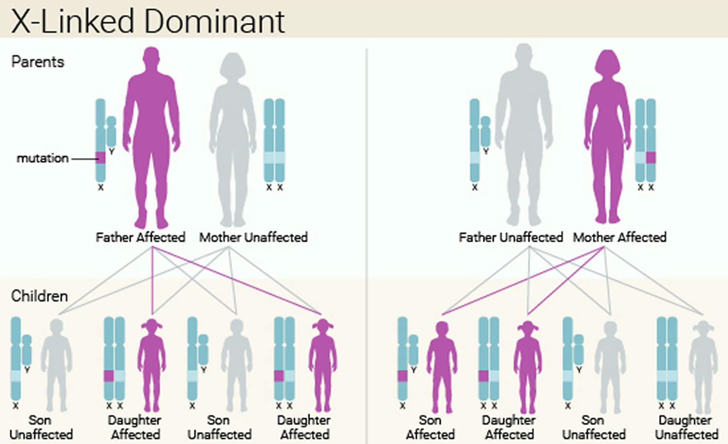 Fragile X syndrome X-linked Dominant inheritance pattern