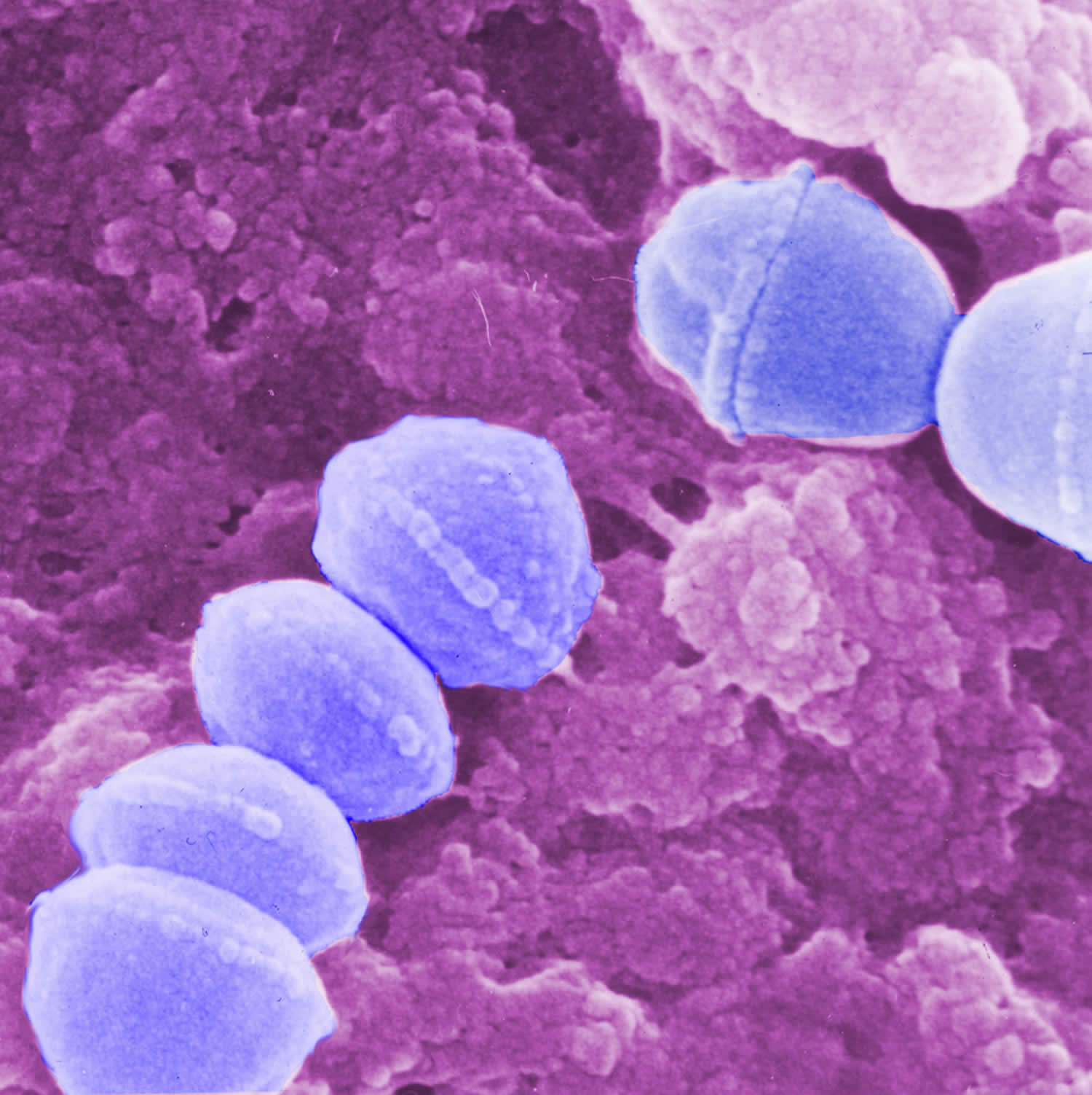 Group A Streptococcus