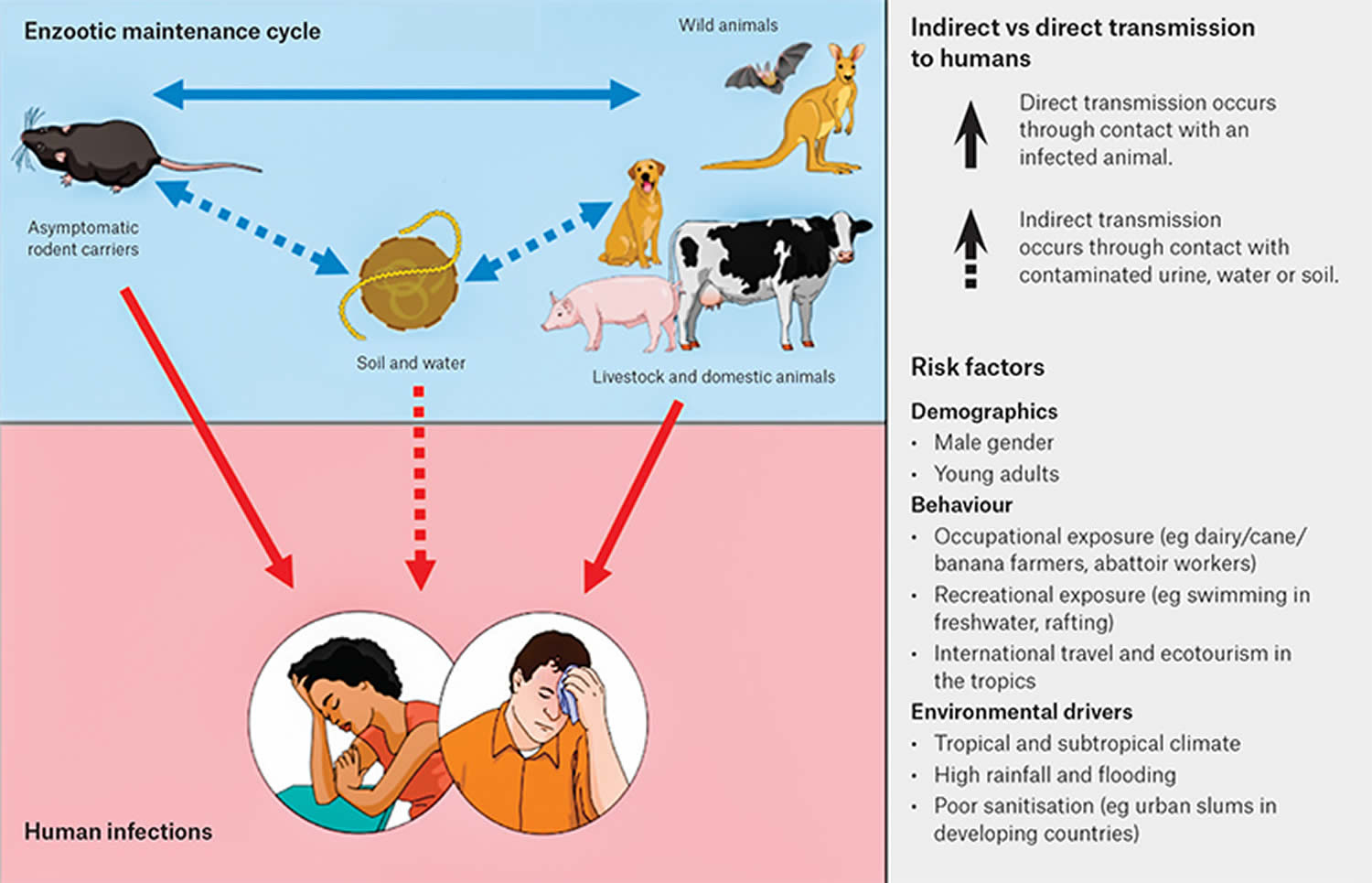 Leptospirosis in humans causes, prevention, symptoms, diagnosis & treatment