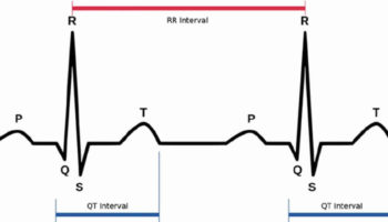 Long QT syndrome