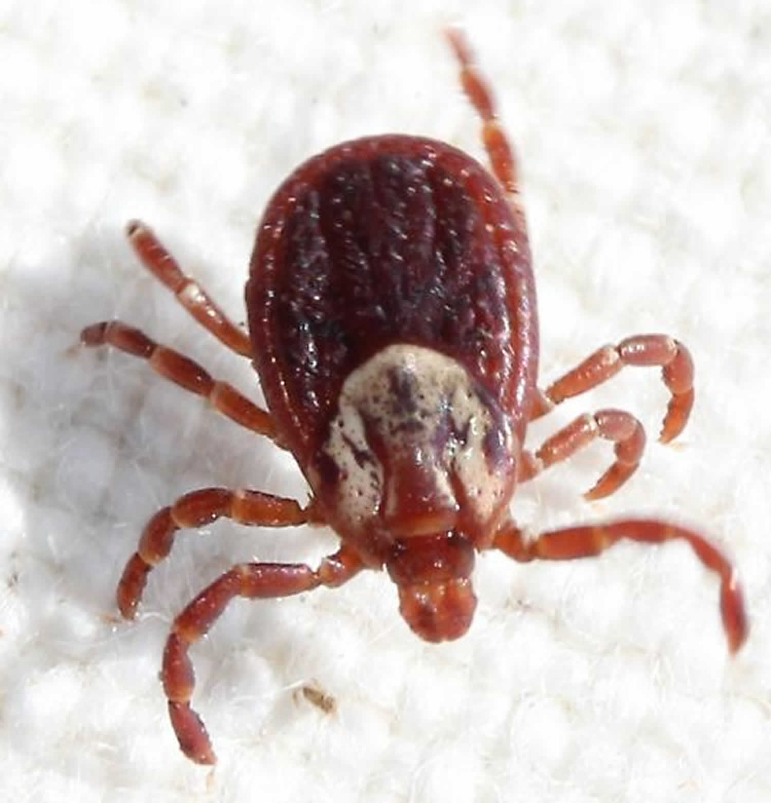 Rocky Mountain Spotted Fever Causes Symptoms Rash And Treatment