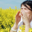 allergic rhinitis