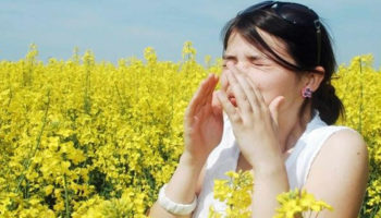 allergic rhinitis
