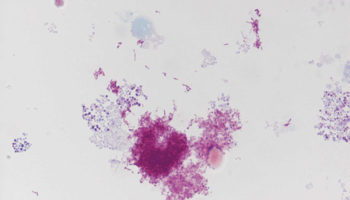 bartonella