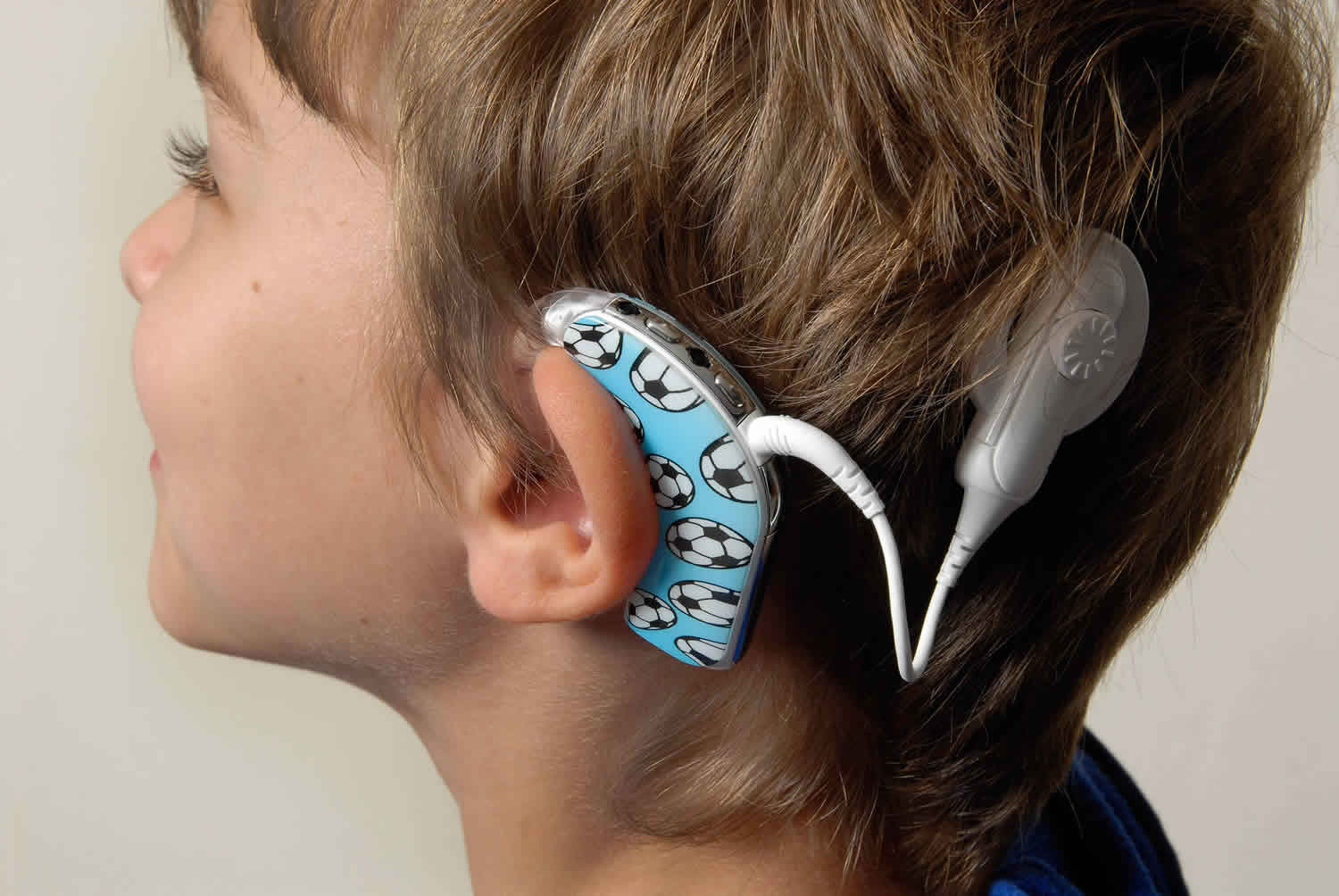 Cochlear Implant Function Surgery And Cochlear Implant Pros And Cons