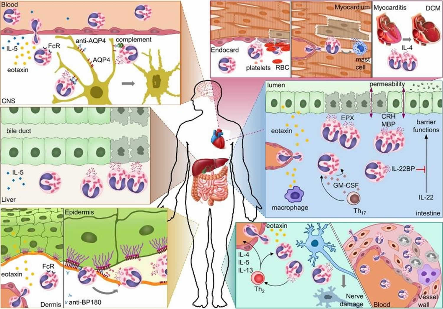 eosinophil-mediated damage in autoimmune diseases