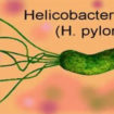 h pylori