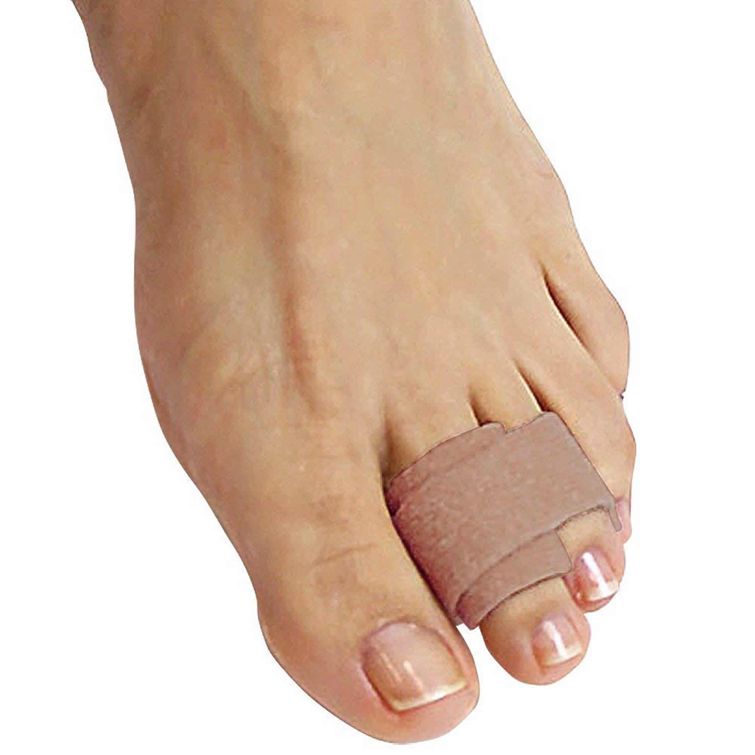 Hammer toe causes, appearance, symptoms and hammer toe treatment