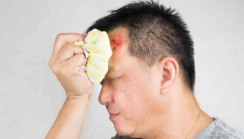 head injury