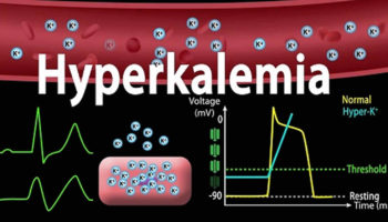 hyperkalemia
