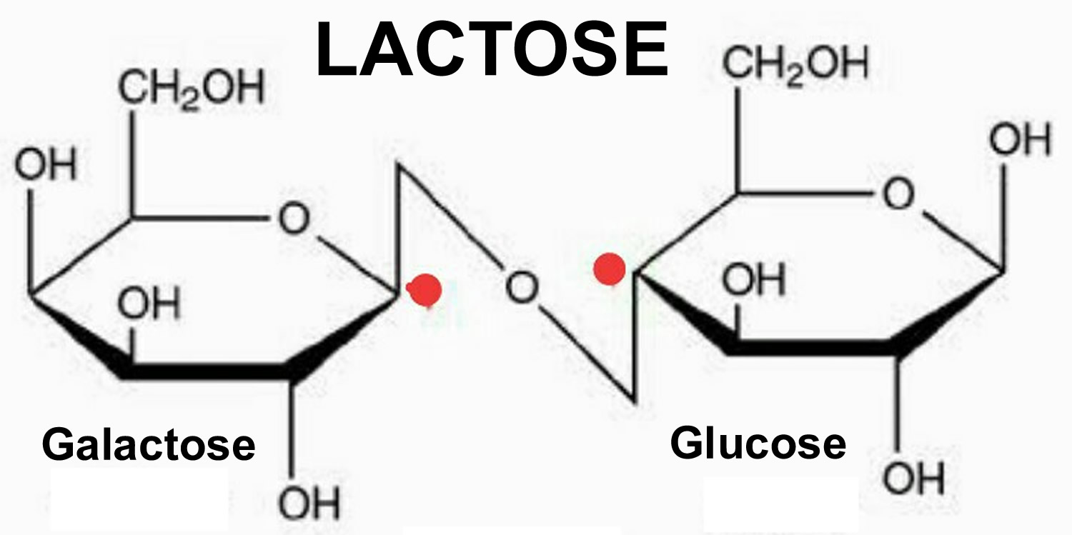 Galactosemia del lactante