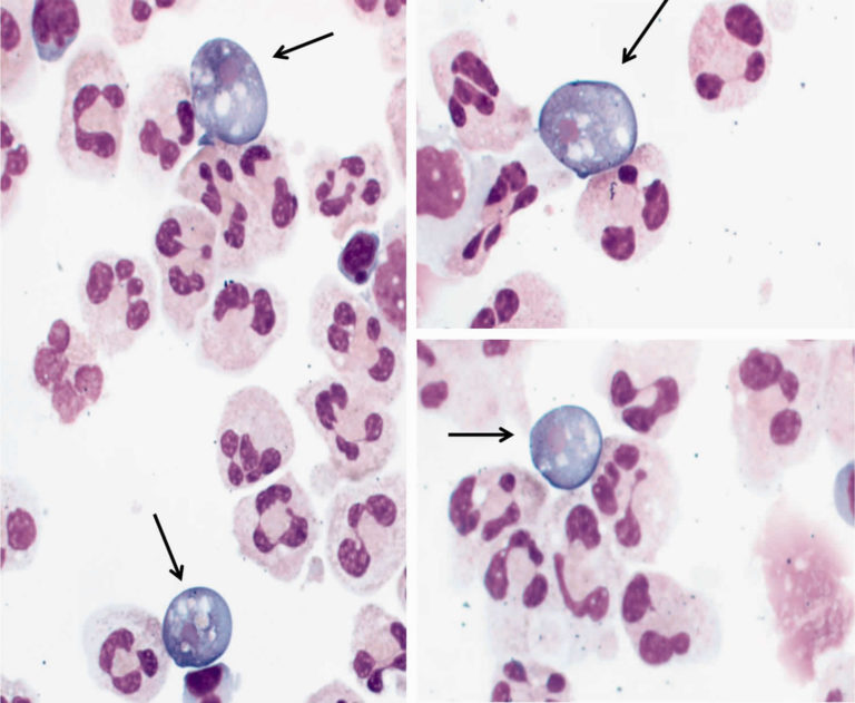 naegleria-fowleri-amoeba-or-brain-eating-amoeba-infection-and-treatment