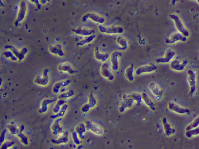 Naegleria Fowleri Amoeba Or Brain Eating Amoeba Infection And Treatment 7259