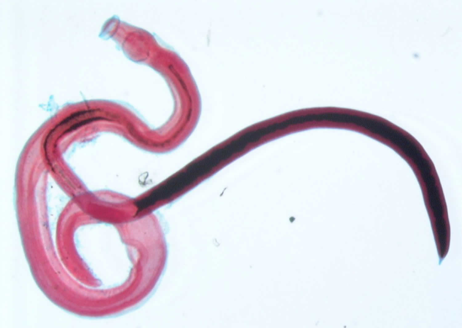 Schistosoma japonicum. Шистосома гематобиум. Шистосома интеркалатум. Кровяная двуустка (Schistosoma haematobium).