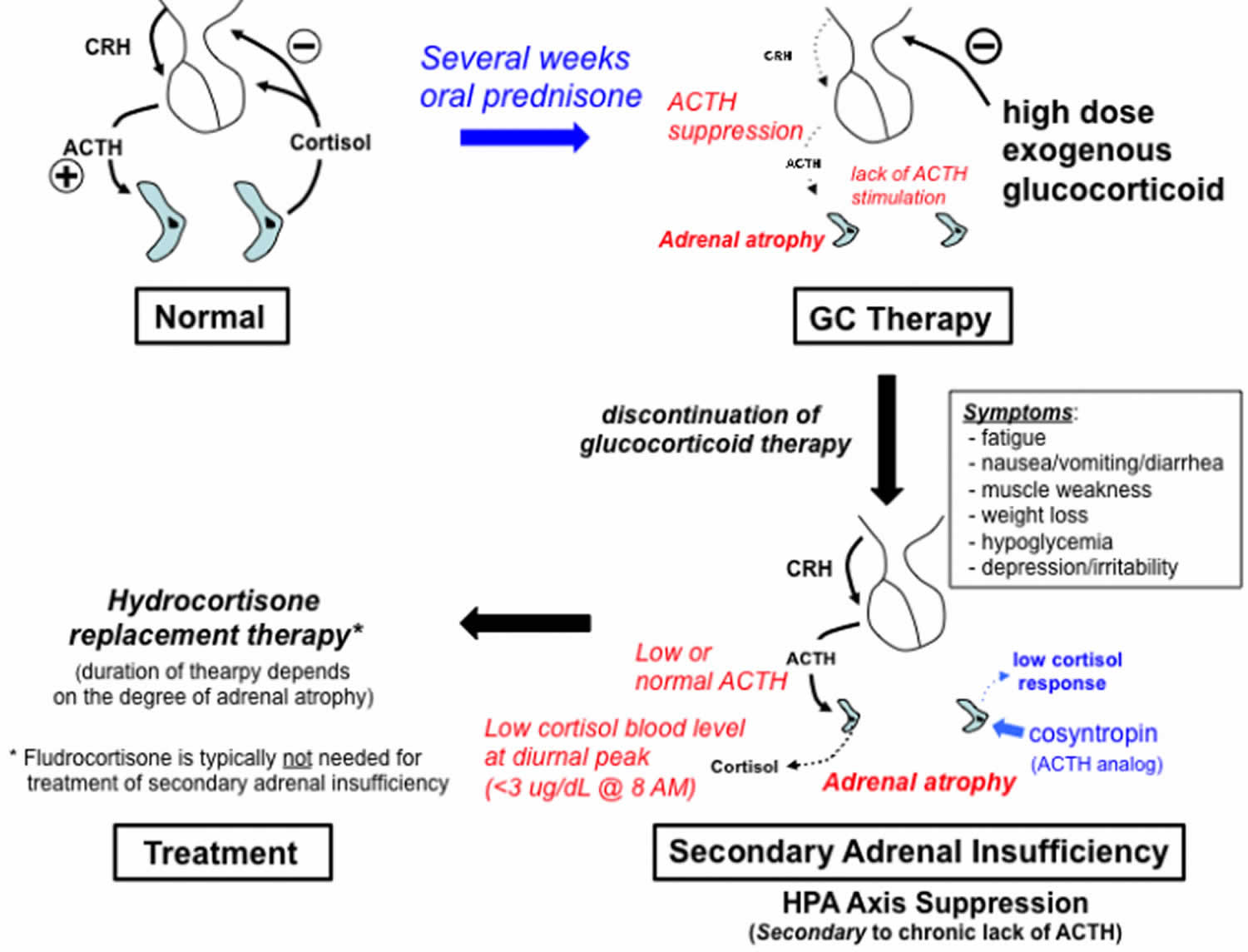 Secondary adrenal insufficiency caused by chronic glucocorticoid treatment