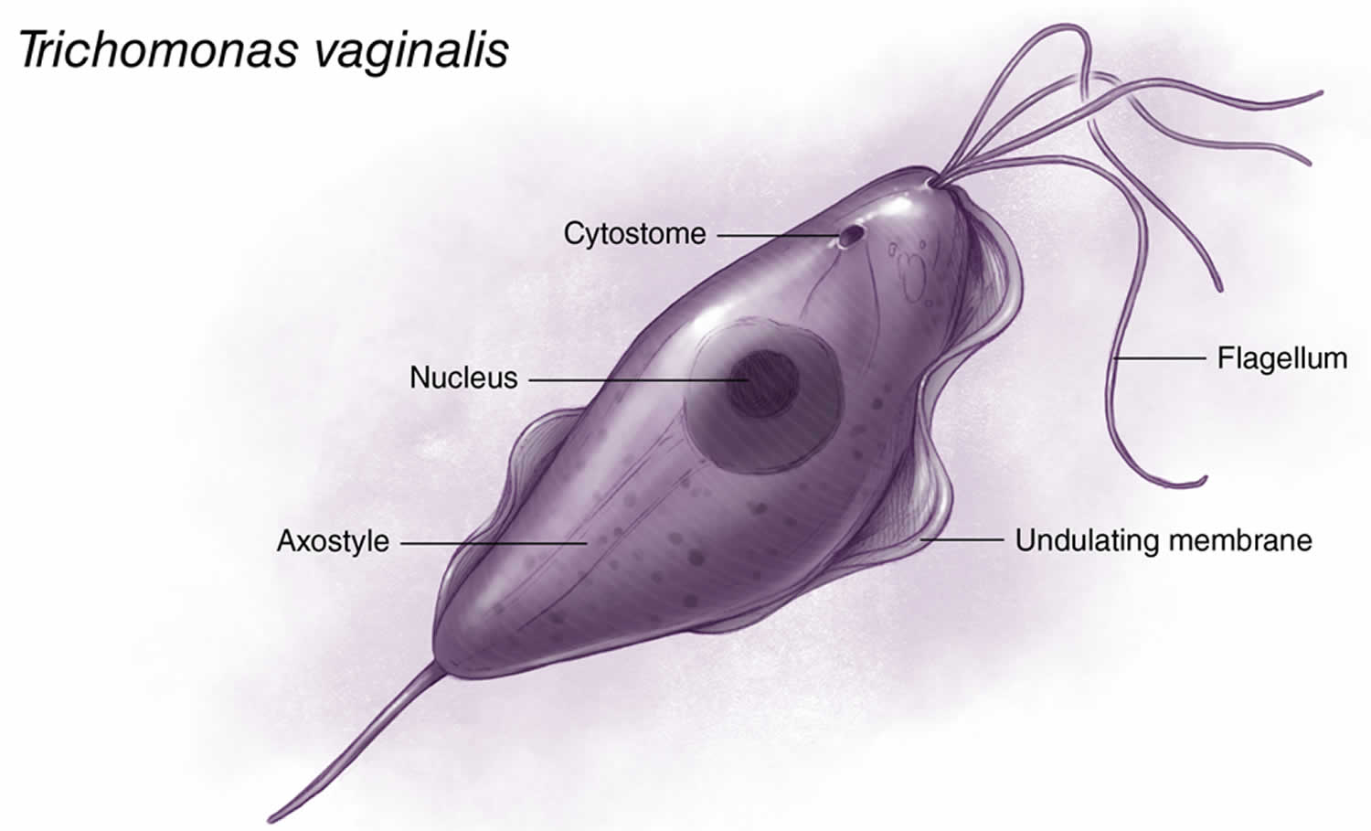 Trichomoniasis causes, symptoms in men & women, diagnosis & treatment