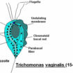 Trichomoniasis