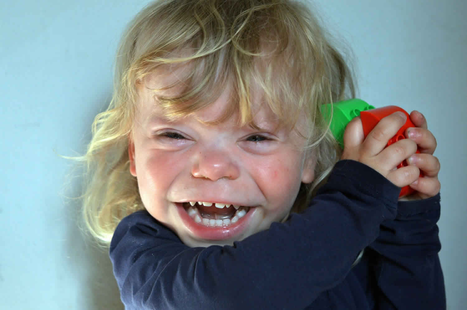 Ребенок с большим ртом. Синдром Уильямса лица эльфа. Синдром Вильямса лицо эльфа фото.