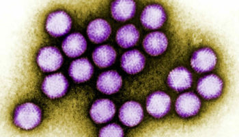adenovirus infection