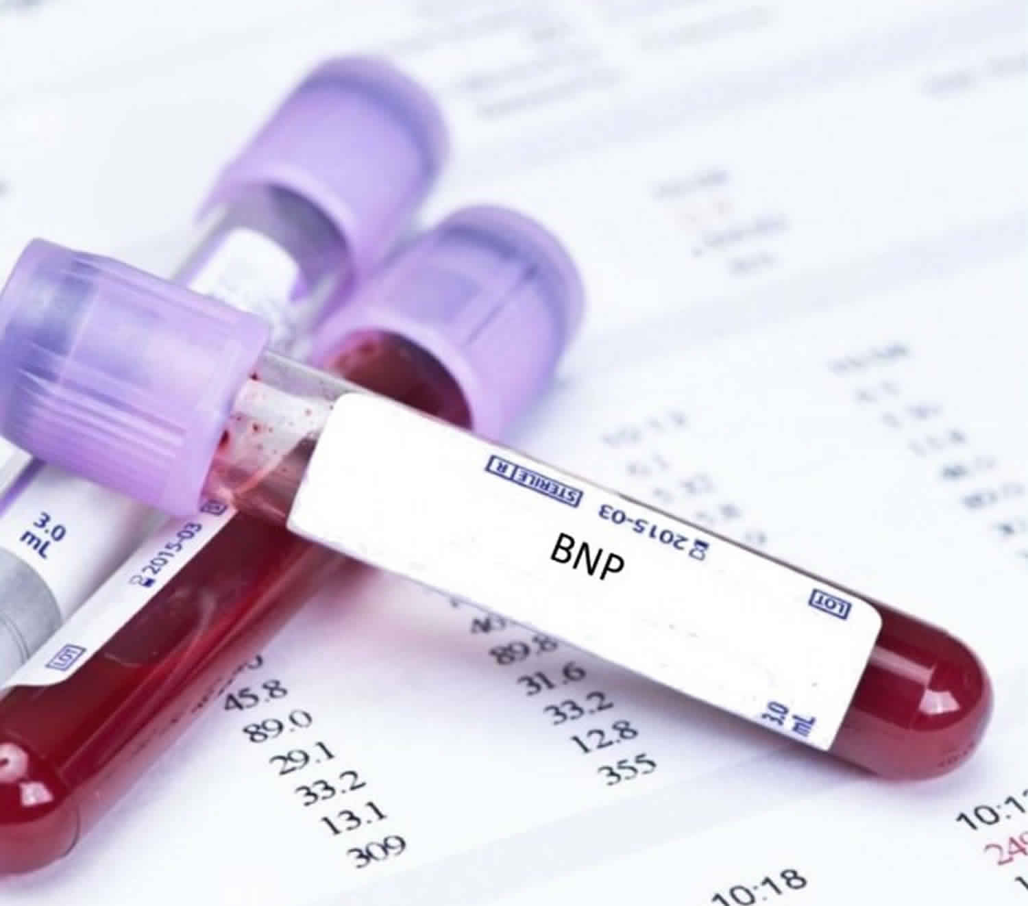 BNP Blood Test Uses BNP Blood Test Normal Range BNP For Heart Failure