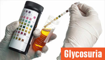 glycosuria