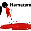 hematemesis