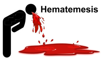 hematemesis