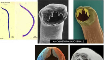 hookworms