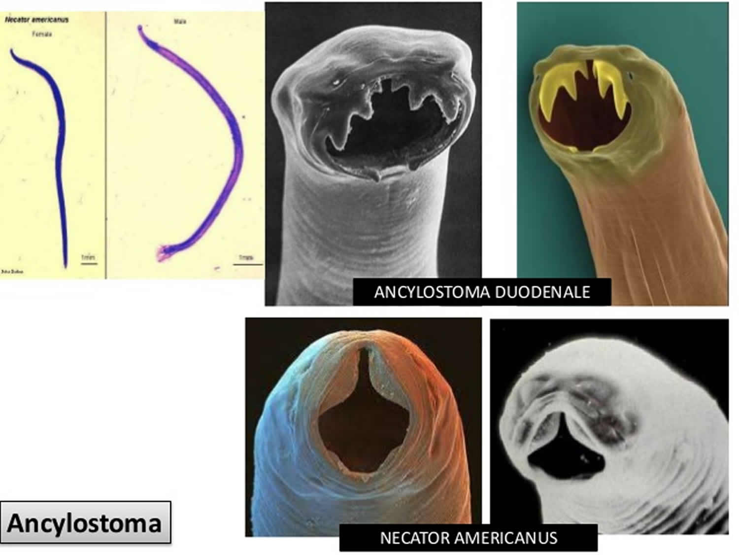 what causes hookworms in humans