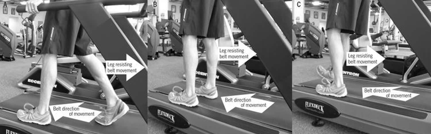 proximal hamstring tendinopathy exercise