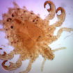pubic lice
