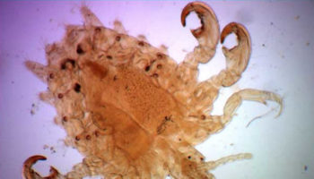 pubic lice