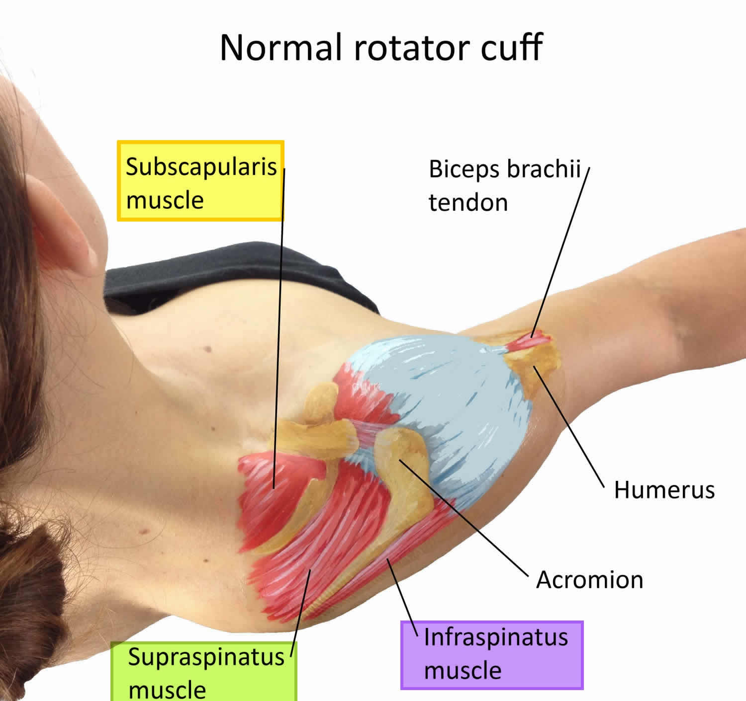 normal shoulder rotator cuff