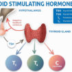thyroid stimulating hormone