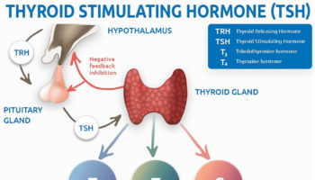 thyroid stimulating hormone