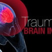 traumatic brain injury