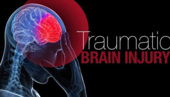 traumatic brain injury