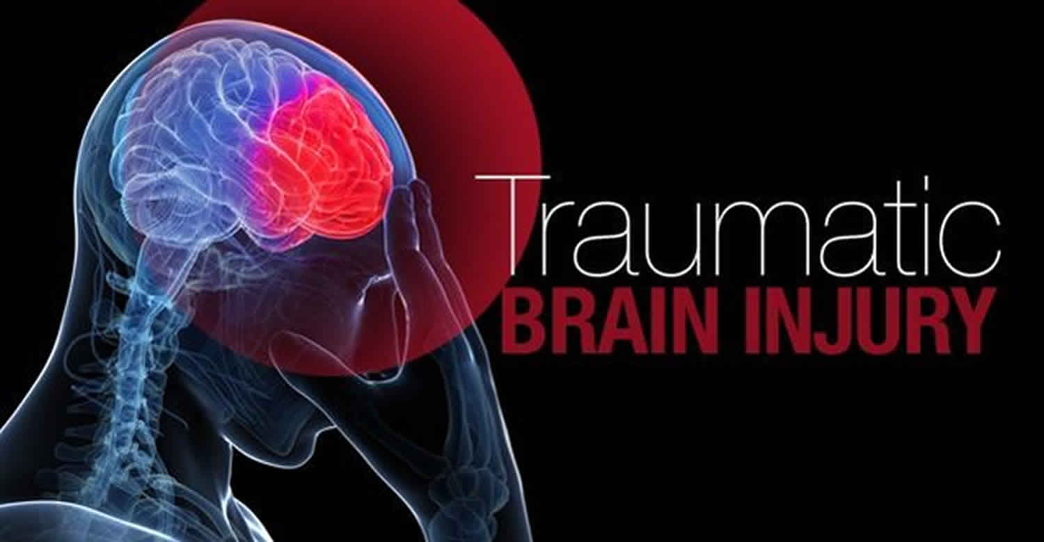 revealing-latent-value-of-clinically-acquired-cts-of-traumatic-brain