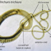 whipworm