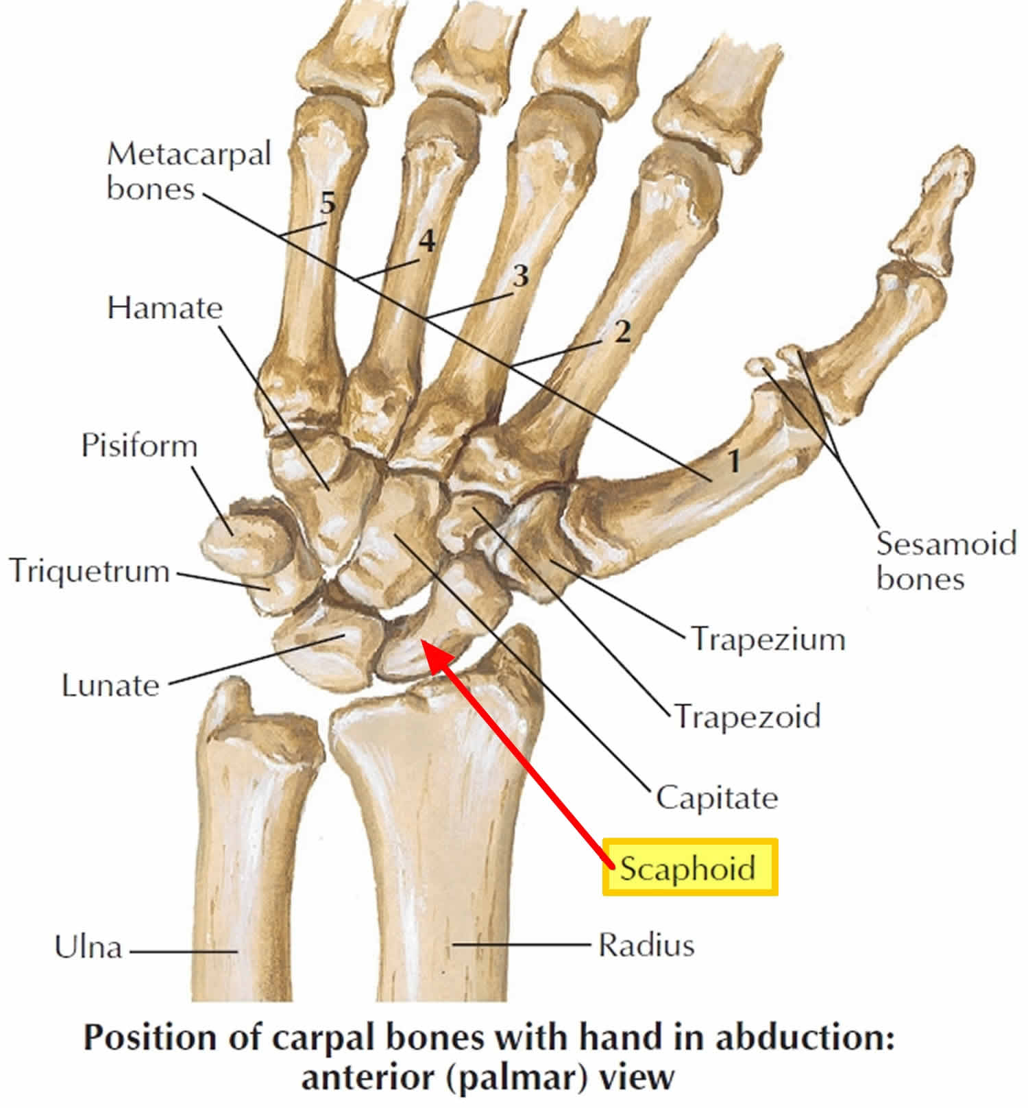 navicular fracture wrist