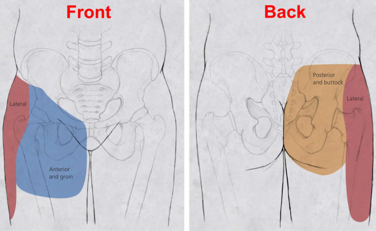 hip-pain-causes-hip-pain-symptoms-diagnosis-and-hip-pain-treatment