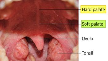Soft palate anatomy