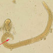 Strongyloides