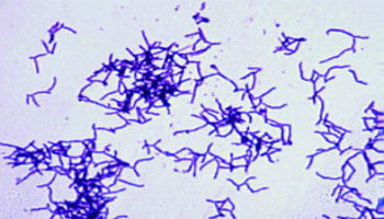 actinomyces israelii