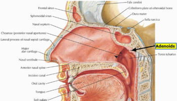 adenoids