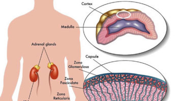 adrenal cancer