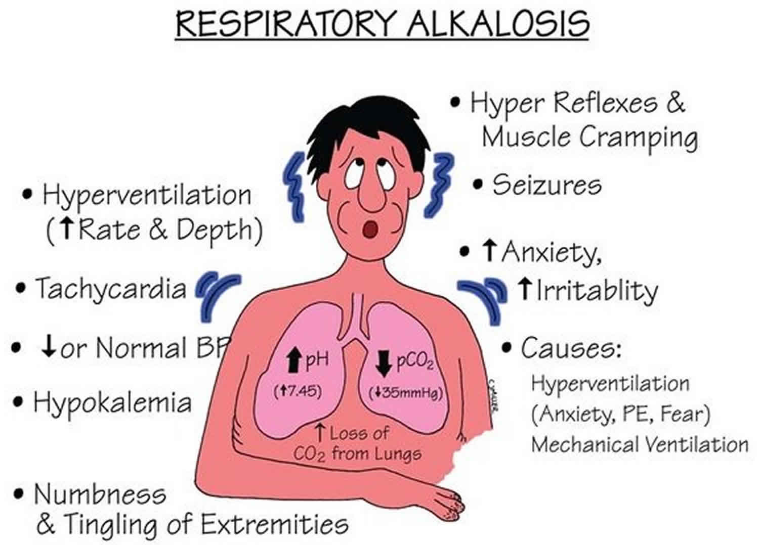 metabolic-alkalosis-respiratory-alkalosis-causes-symptoms-treatment