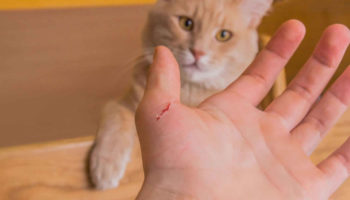 cat scratch disease